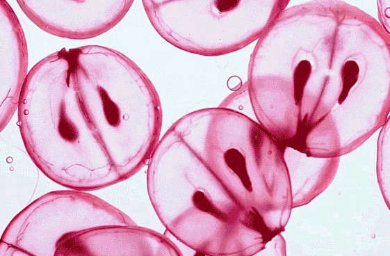 Resveratrol: Multiple liver care